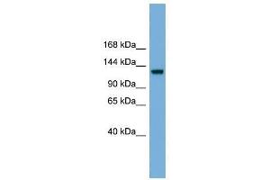 RASGRF1 antibody used at 0. (RASGRF1 抗体  (Middle Region))