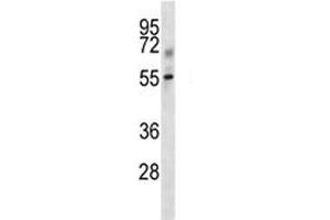 Tgfbr1 antibody western blot analysis in mouse kidney tissue lysate. (TGFBR1 抗体  (AA 141-169))