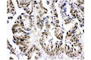 IHC analysis of KDM5B using anti-KDM5B antibody (ABIN4886648).