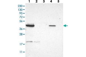 Western blot analysis of Lane 1: RT-4, Lane 2: U-251 MG, Lane 3: Human Plasma, Lane 4: Liver, Lane 5: Tonsil with GRAMD3 polyclonal antibody  at 1:250-1:500 dilution. (GRAMD3 抗体)