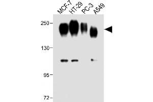 All lanes : Anti-CEA Antibody (Center) at 1:1000 dilution Lane 1: MCF-7 whole cell lysate Lane 2: HT-29 whole cell lysate Lane 3: PC-3 whole cell lysate Lane 4: A549 whole cell lysate Lysates/proteins at 20 μg per lane. (CEA 抗体  (AA 400-429))