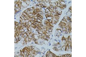 Immunohistochemistry of paraffin-embedded human stomach using CLDN3 antibody (ABIN3017039, ABIN3017040, ABIN3017041, ABIN1679261 and ABIN6219930) (40x lens). (Claudin 3 抗体)