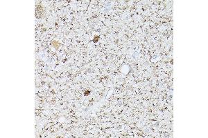 anti-Ubiquitin Carboxyl-terminal Esterase L1 (Ubiquitin Thiolesterase) (UCHL1) (AA 1-220) antibody