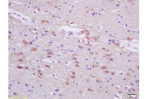 Formalin-fixed and paraffin embedded rat brain labeled with Anti-ASN/Fatty Acid Synthase 1 Polyclonal Antibody, Unconjugated (ABIN687382) at 1:200, followed by conjugation to the secondary antibody and DAB staining (Fatty Acid Synthase 抗体  (AA 651-750))