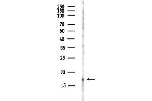 Western blot analysis of lysates from Hela cells(UV, 30 min treatment), using BTG2 Antibody at 1/1000 dilution.
