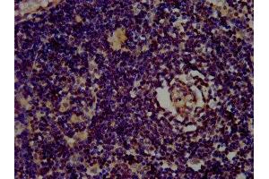 IHC image of ABIN7153444 diluted at 1:400 and staining in paraffin-embedded human lymph node tissue performed on a Leica BondTM system. (Galectin 10 抗体  (AA 2-142))