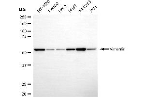 Western blotting analysis using vimentin antibody (ABIN7800836). (Vimentin 抗体)