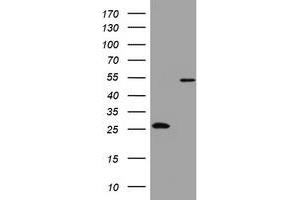 Image no. 4 for anti-3-Oxoacyl-ACP Synthase, Mitochondrial (OXSM) (AA 78-343) antibody (ABIN1491674)