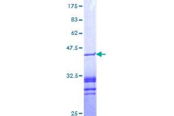 PAWR Protein (AA 231-340) (GST tag)