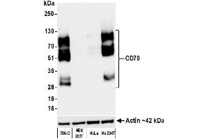 Western Blotting (WB) image for anti-CD70 Molecule (CD70) (AA 50-193) antibody (ABIN7449156) (Recombinant CD70 抗体  (AA 50-193))