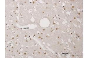 Image no. 1 for anti-TP53 Regulating Kinase (TP53RK) (AA 154-253) antibody (ABIN466264) (TP53RK 抗体  (AA 154-253))