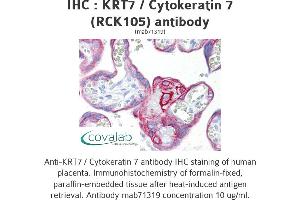 Image no. 1 for anti-Keratin 7 (KRT7) antibody (ABIN1724125) (Cytokeratin 7 抗体)