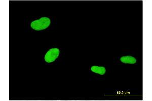 Immunofluorescence of monoclonal antibody to ZKSCAN4 on HeLa cell. (ZKSCAN4 抗体  (AA 1-545))