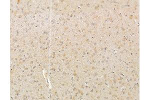 ABIN6265291 and ABIN6279800 at 1/100 staining rat brain tissue by IHC-P. (SRPK2 抗体)