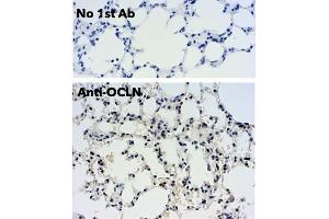 Immunohistochemistry (IHC) image for anti-Occludin (OCLN) (C-Term) antibody (ABIN7273069) (Occludin 抗体  (C-Term))