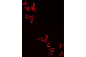 Immunofluorescence (fixed cells) (IF/ICC) image for anti-Glutamate Receptor, Metabotropic 4 (GRM4) (C-Term) antibody (ABIN6261989)