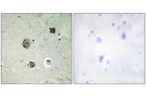 Immunohistochemistry analysis of paraffin-embedded human brain tissue using CDK5 (epitope around residue 15) antibody. (CDK5 抗体  (Tyr15))