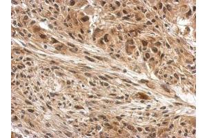 IHC-P Image Immunohistochemical analysis of paraffin-embedded U373 xenograft, using DDB1, antibody at 1:500 dilution. (DDB1 抗体  (C-Term))