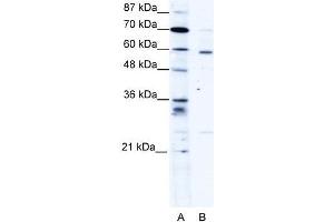 Human HepG2; WB Suggested Anti-PDLIM5 Antibody Titration: 1. (PDLIM5 抗体  (Middle Region))