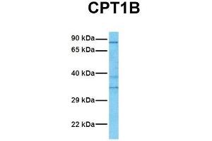 Western Blotting (WB) image for anti-Carnitine Palmitoyltransferase 1B (Muscle) (CPT1B) (Middle Region) antibody (ABIN2782633)