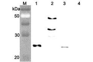 Western blot analysis of human FGF21 using anti-FGF-21 (human), pAb  at 1:4,000 dilution. (FGF21 抗体)