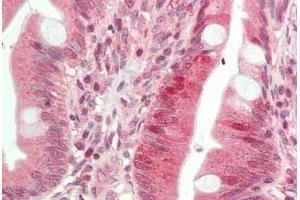 Human Small Intestine: Formalin-Fixed, Paraffin-Embedded (FFPE)