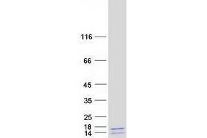 Validation with Western Blot