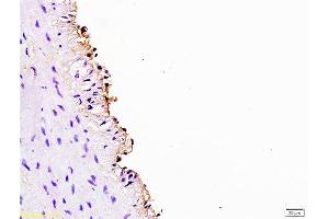 Formalin-fixed and paraffin embedded rabbit carotid artery labeled Anti-Cyclin D3 Polyclonal Antibody, Unconjugated  at 1:200, followed by conjugation to the secondary antibody and DAB staining (Cyclin D3 抗体  (AA 121-220))