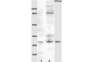 L1 rat kidney lysates L2 rat brain lysates probed with Anti IGFBP3 Polyclonal Antibody, Unconjugated (ABIN686497) at 1:200 overnight at 4 °C. (IGFBP3 抗体  (AA 186-292))