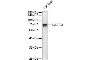 Western blot analysis of extracts of Rat liver, using IL22R antibody (0941) at 1:500 dilution.