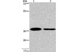 Western blot analysis of 293T and A549 cell, using SNAI1 Polyclonal Antibody at dilution of 1:200 (SNAIL 抗体)