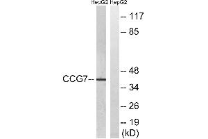 Western blot analysis of extracts from HepG2 cells, using CACNG7 antibody. (CACNG7 抗体  (Internal Region))