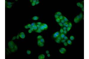 Immunofluorescence staining of PC-3 cells with ABIN7145507 at 1:100, counter-stained with DAPI. (Hexosaminidase A 抗体  (AA 89-529))