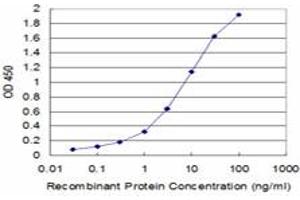 Detection limit for recombinant GST tagged UROD is approximately 0. (UROD 抗体  (AA 268-367))