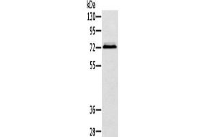 Western Blotting (WB) image for anti-Synovial Sarcoma, X Breakpoint 2 Interacting Protein (SSX2IP) antibody (ABIN2424211)