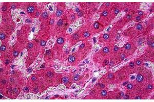 Human Liver: Formalin-Fixed, Paraffin-Embedded (FFPE) (Complement C3c 抗体)