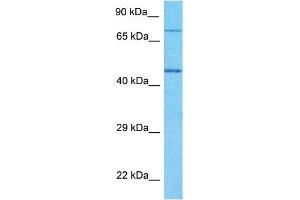 Host:  Rabbit  Target Name:  GNPAT  Sample Type:  Jurkat Whole Cell lysates  Antibody Dilution:  1. (GNPAT 抗体  (N-Term))