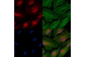 Phospho-MeCP2 (Ser423) Antibody staining A549 cells(heat shock treatment) by IF/ICC. (MECP2 抗体  (pSer423))