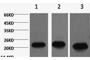 Western Blot analysis of 1) MCF7, 2) Rat kidney, 3) Mouse brain using PRDX1 Monoclonal Antibody at dilution of 1:2000. (Peroxiredoxin 1 抗体)