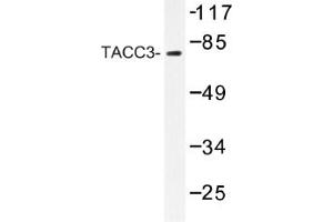 Image no. 1 for anti-Transforming, Acidic Coiled-Coil Containing Protein 3 (TACC3) antibody (ABIN317622) (TACC3 抗体)