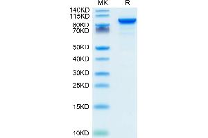 ENPP2 Protein (AA 49-862) (His tag)