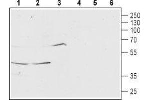 Western blot analysis of rat brain (lanes 1 and 4), mouse brain (lanes 2 and 5) and human SH-SY5Y (lanes 3 and 6) lysates: - 1-3. (MCHR1 抗体  (Extracellular, N-Term))