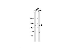 Western Blot at 1:2000 dilution Lane 1: Jurkat whole cell lysate Lane 2: Raji whole cell lysate Lysates/proteins at 20 ug per lane. (WHSC1 抗体  (C-Term))