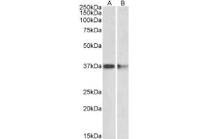ABIN5539476 (2µg/ml) staining of Mouse (A) and Rat (B) Brain lysates (35µg protein in RIPA buffer). (PRMT2 抗体  (Internal Region))