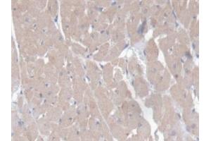 Detection of CD7 in Rat Heart Tissue using Polyclonal Antibody to Cluster Of Differentiation 7 (CD7)