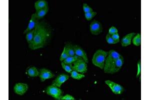 Immunofluorescent analysis of HepG2 cells using ABIN7160861 at dilution of 1:100 and Alexa Fluor 488-congugated AffiniPure Goat Anti-Rabbit IgG(H+L) (SIRT3 抗体  (AA 20-130))