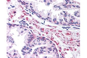 Anti-LEF1 antibody IHC of human prostate. (LEF1 抗体  (AA 51-100))