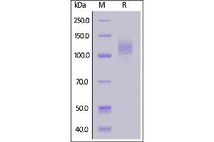 SDS-PAGE (SDS) image for SARS-CoV-2 Spike S1 (P.1 - gamma) (Active) protein (His tag) (ABIN6992361)