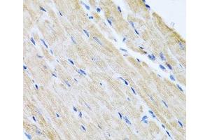 Immunohistochemistry (Paraffin-embedded Sections) (IHC (p)) image for anti-ATP-Binding Cassette, Sub-Family B (MDR/TAP), Member 8 (ABCB8) antibody (ABIN7260613)