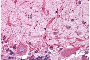Human Brain, Cerebellum (formalin-fixed, paraffin-embedded) stained with GRIK2 antibody ABIN214767 at 5 ug/ml followed by biotinylated goat anti-rabbit IgG secondary antibody ABIN481713, alkaline phosphatase-streptavidin and chromogen. (GRIK2 抗体  (AA 652-701))
